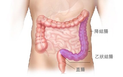 降結腸 乙狀結腸 直腸