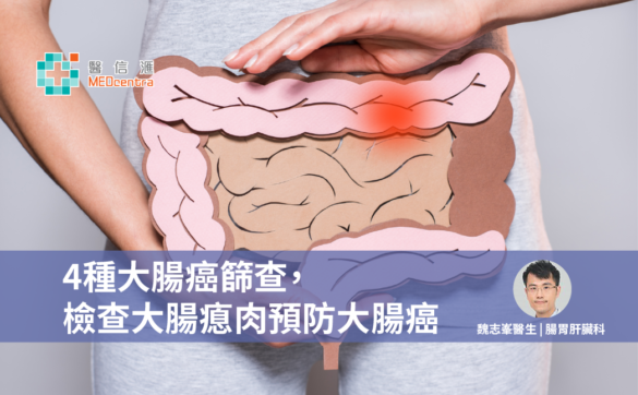 4種大腸癌篩查，檢查大腸瘜肉預防大腸癌 魏志峯醫生