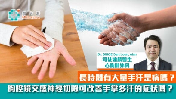 交感神經切除術治療手掌多汗症