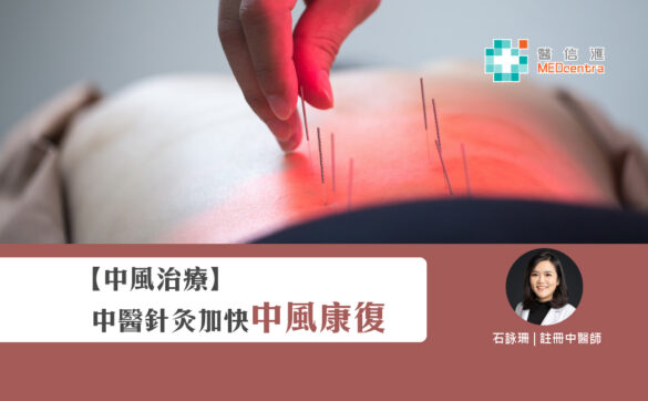 中風治療 中醫針灸加快中風康復 石詠珊中醫師