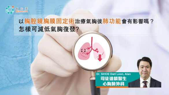 以胸腔鏡胸膜固定術治療氣胸後肺功能會有影響嗎 司徒達麟 醫生