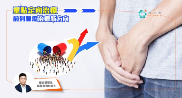 前列腺癌治療新方向