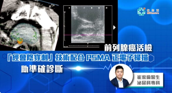 前列腺癌活檢「經會陰穿刺」技術配合 PSMA 正電子掃描 助準確診斷