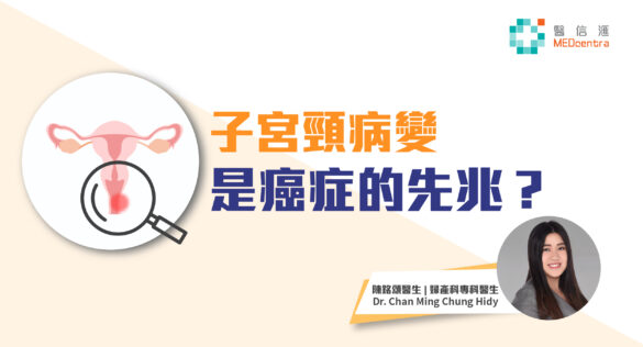 子宮頸病變是否癌症的先兆 陳銘頌醫生