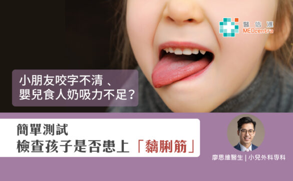 小朋友咬字不清 嬰兒食人奶吸力不足 簡單測試檢查是否患上黐脷筋 廖思維醫生