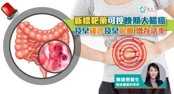 新標靶藥可控晚期大腸癌