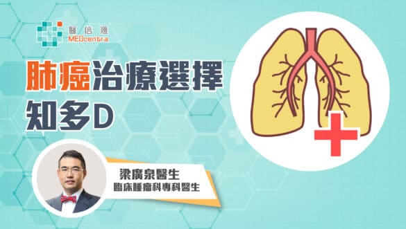 肺癌治療的選擇