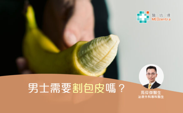 男士需要割包皮嗎 馬偉傑醫生2