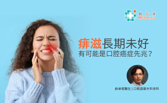 痱滋長期未好 有可能是口腔癌症先兆 蘇卓恒醫生