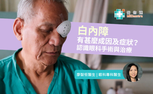白內障有甚麼成因及症狀？認識眼科手術與治療 廖智恒 醫生