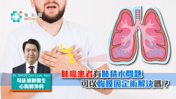 肺癌患者有肺積水問題可以做胸膜固定術