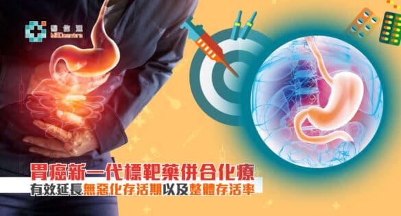 胃癌新一代標靶藥併合化療有效延長無惡化存活期以及整體存活率