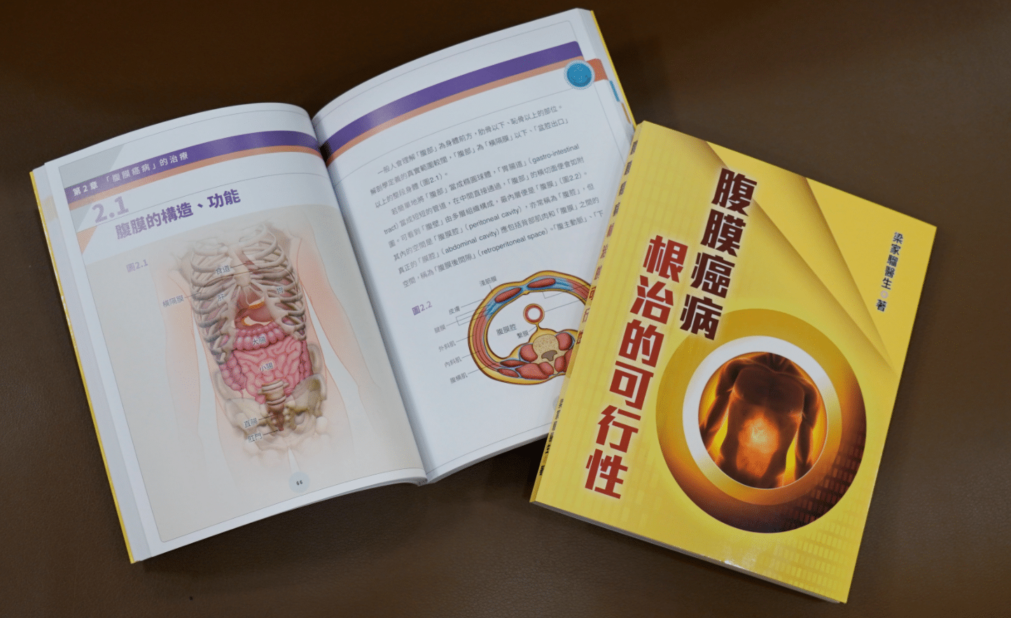 腹膜癌病根治的可行性-梁家騮醫生