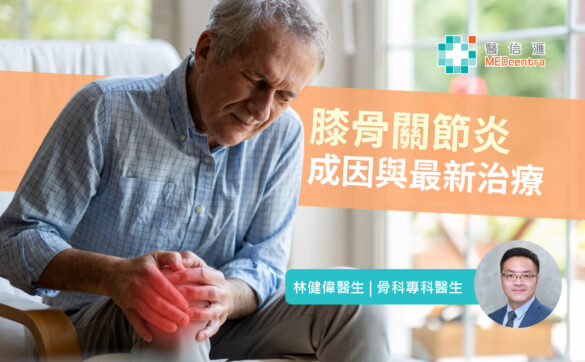 膝骨關節炎成因與最新治療 | 林健偉醫生
