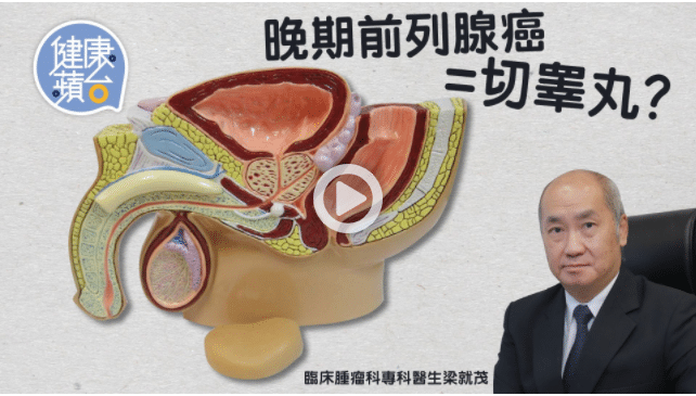尿頻骨痛屬前列腺癌症狀 晚期患者可用荷爾蒙治療及化療改善